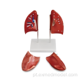 Modelo de anatomia pulmonar esquerda e direita